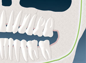 sinus03
