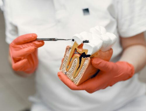 Understanding Pulpitis: Tooth Pain Explained