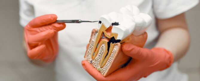Understanding Pulpitis: Tooth Pain Explained