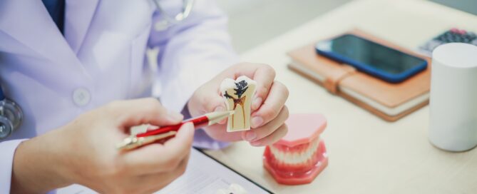 Essential Care After Root Canal Treatment