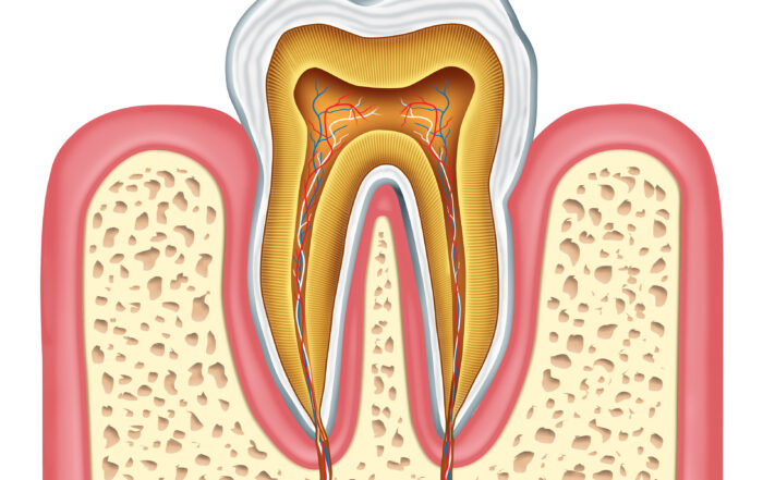Signs You Need a Root Canal: Key Symptoms