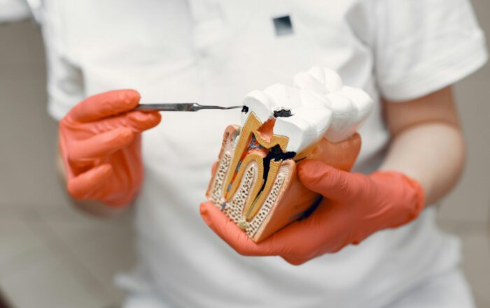 Understanding Root Canal Costs and Coverage