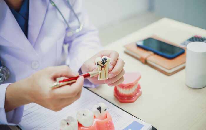 Root Canal vs Extraction: Which Is Better?