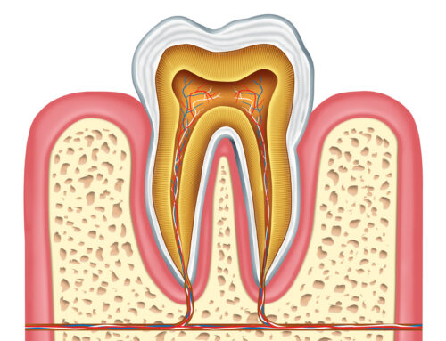 Key Signs You May Need a Root Canal Treatment