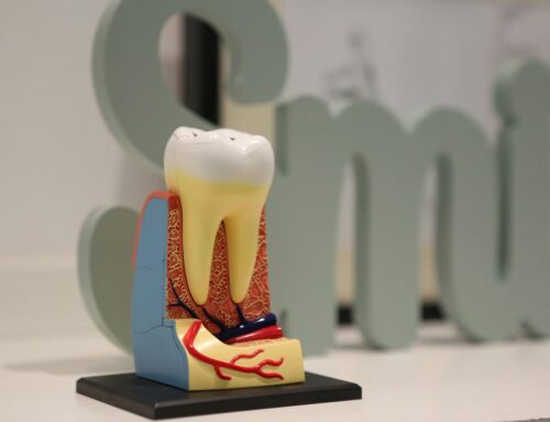 Root Canal Myths vs Facts: The Truth