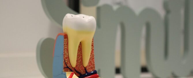 Root Canal Myths vs Facts: The Real Truth