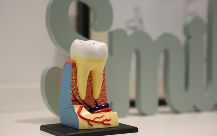 Root Canal Myths vs Facts: The Real Truth