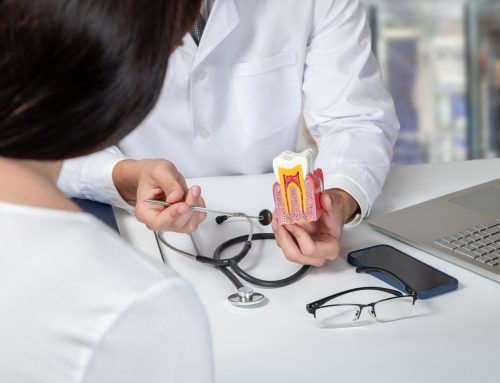 Root Canal Explained: What You Need to Know