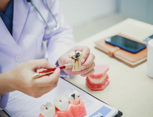 Root Canal Procedure: Step-by-Step Guide